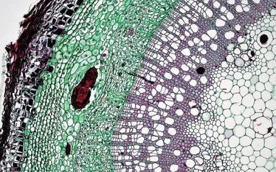 Flow Cytometry in Stem Cell Research and Therapy