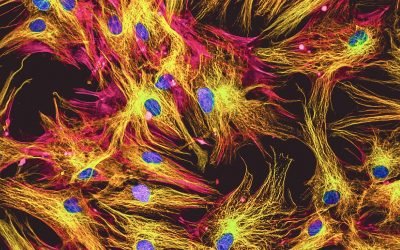 Choosing the Right Fluorescent Immunoassay for Your Research