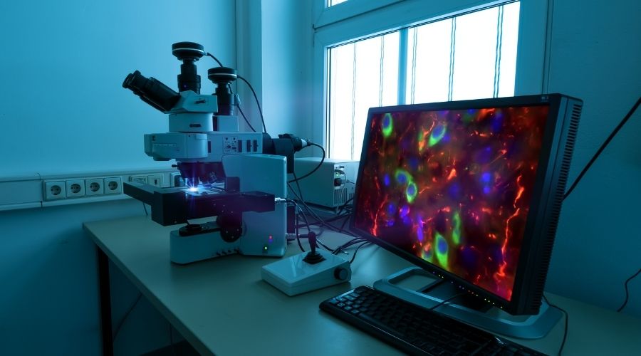 Fluorescence Microscopy