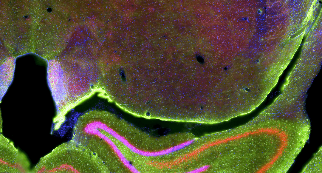 fluorescence view of rat brain slice