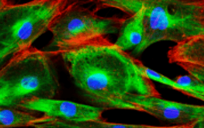 Newsletter: Intracellular Flow Cytometry Fundamentals