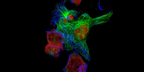 Overview of Advanced Fluorescence Microscopy Techniques